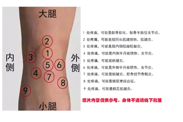 关节炎？髌骨炎？滑膜炎？如何判断各类膝盖疼痛的原因及辨别疾病